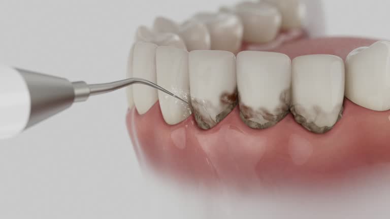 Reliable Emergency Dentist contractor in Gilbert, MN by Smile Center Dentistry